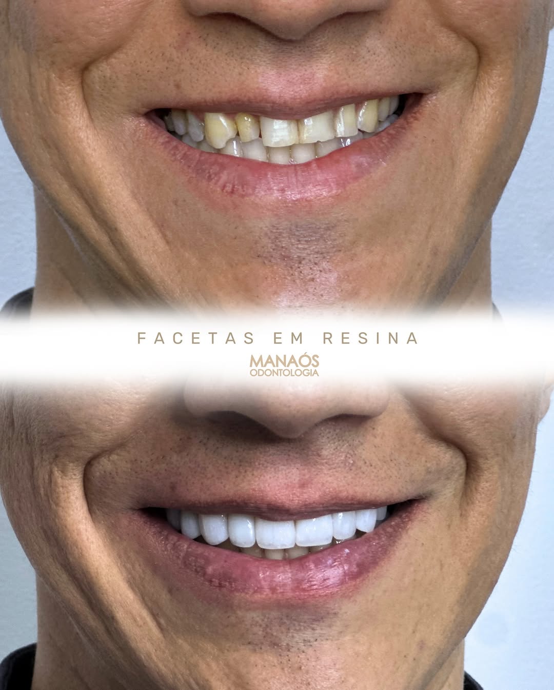 Sorriso renovado
